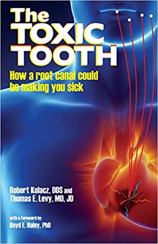 Root Canal Ebooks pdf